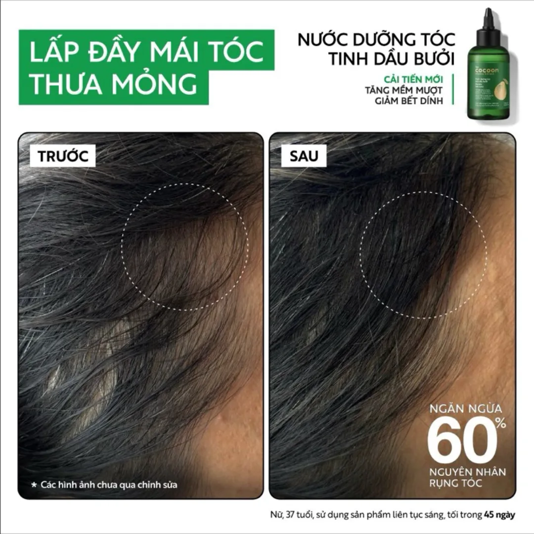 Nước Dưỡng Tóc Cocoon Pomelo Hair Tonic Tinh Dầu Bưởi Hỗ Trợ Giảm Rụng Tóc Cho Tóc Yếu Thưa Mỏng 310ml 5