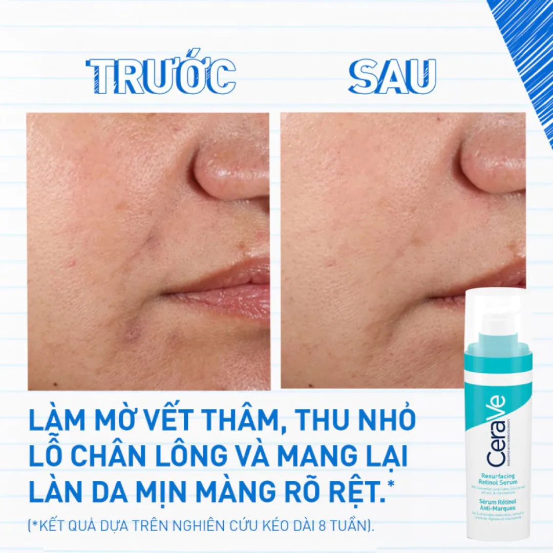 Serum CeraVe Resurfacing Retinol Serum Hỗ Trợ Mờ Thâm Mụn Cải Thiện Kết Cấu Da Se Lỗ Chân Lông 30ml 3