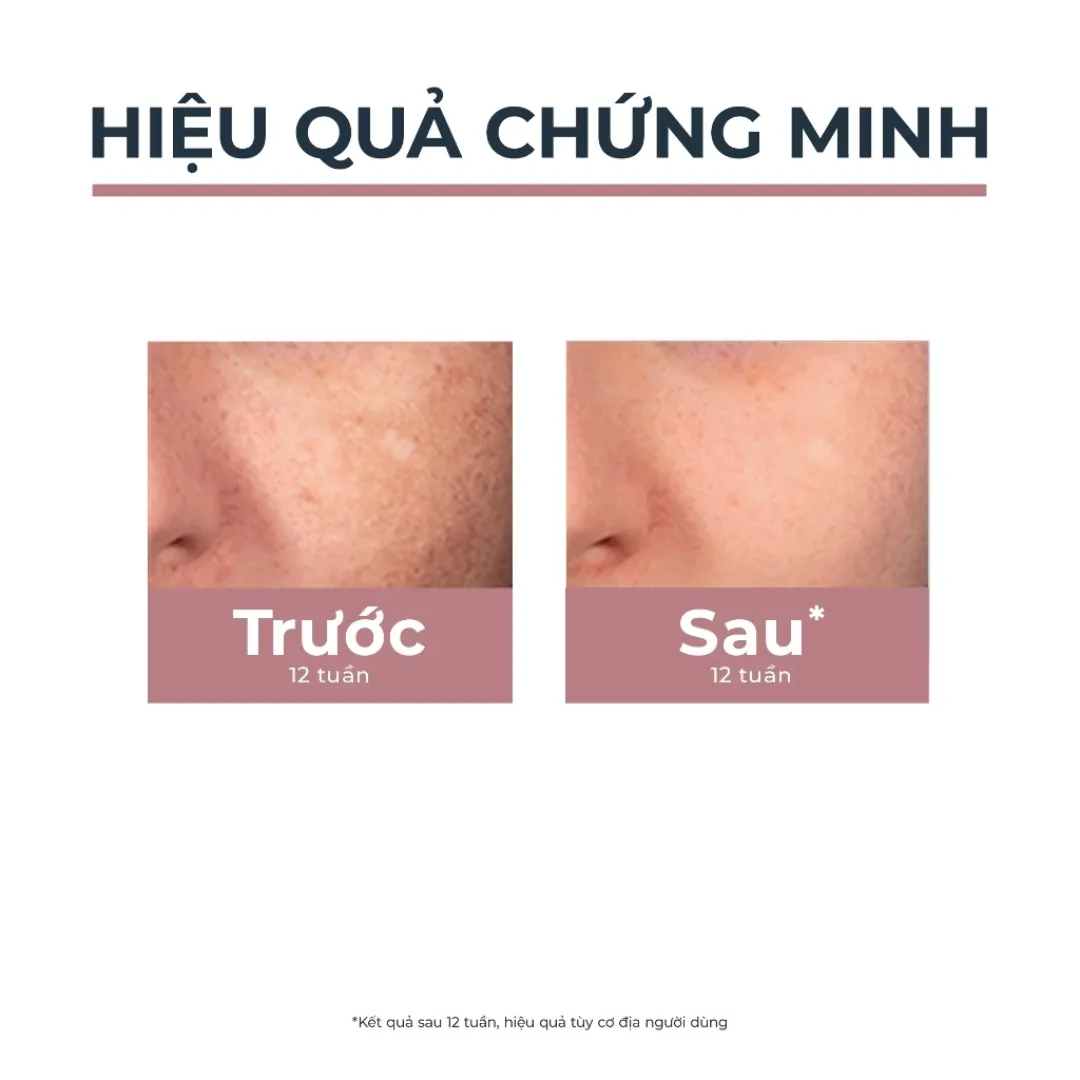 Bút Chấm Eucerin Spotless Brightening Spot Corrector Thiamidol Hỗ Trợ Làm Mờ Đốm Nâu Thâm Nám 5ml 4