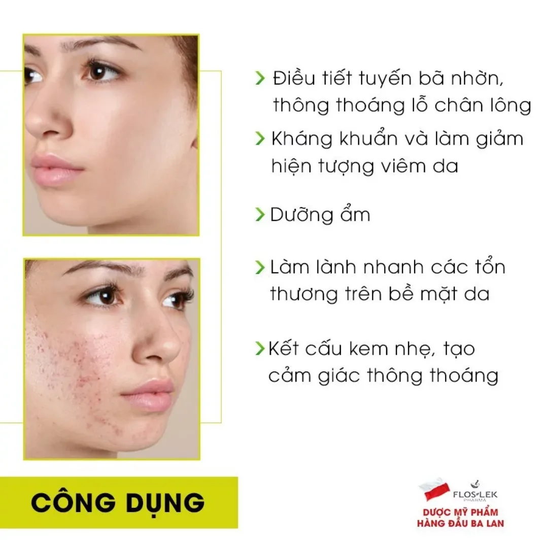 Kem Dưỡng Ẩm Kiềm Dầu Floslek Anti Acne Mattifying Cream 24H Giảm Bóng Nhờn Làm Dịu Da Dầu Mụn 50ml 5