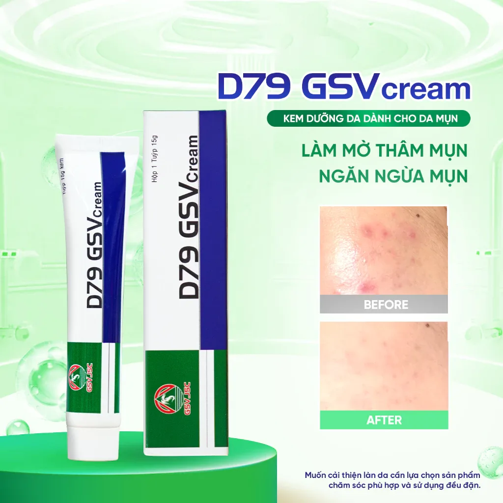 Kem Dưỡng D79 GSV Cream Hỗ Trợ Ngăn Ngừa Mụn Mờ Thâm Kiểm Soát Dầu Nhờn Cho Mặt Ngực Lưng 15g 5