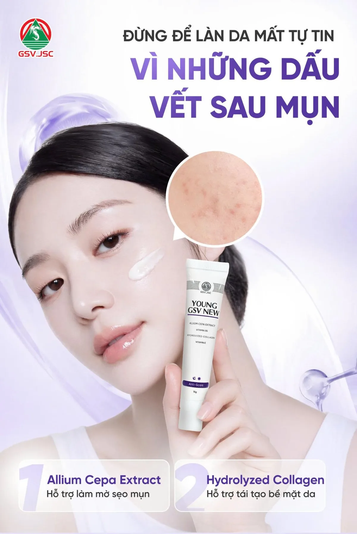 Gel Làm Mờ Sẹo Young GSV New Hỗ Trợ Giảm Thâm Mụn Sạm Nám Tái Tạo Da Với Allium Cepa Và Collagen 15g 2