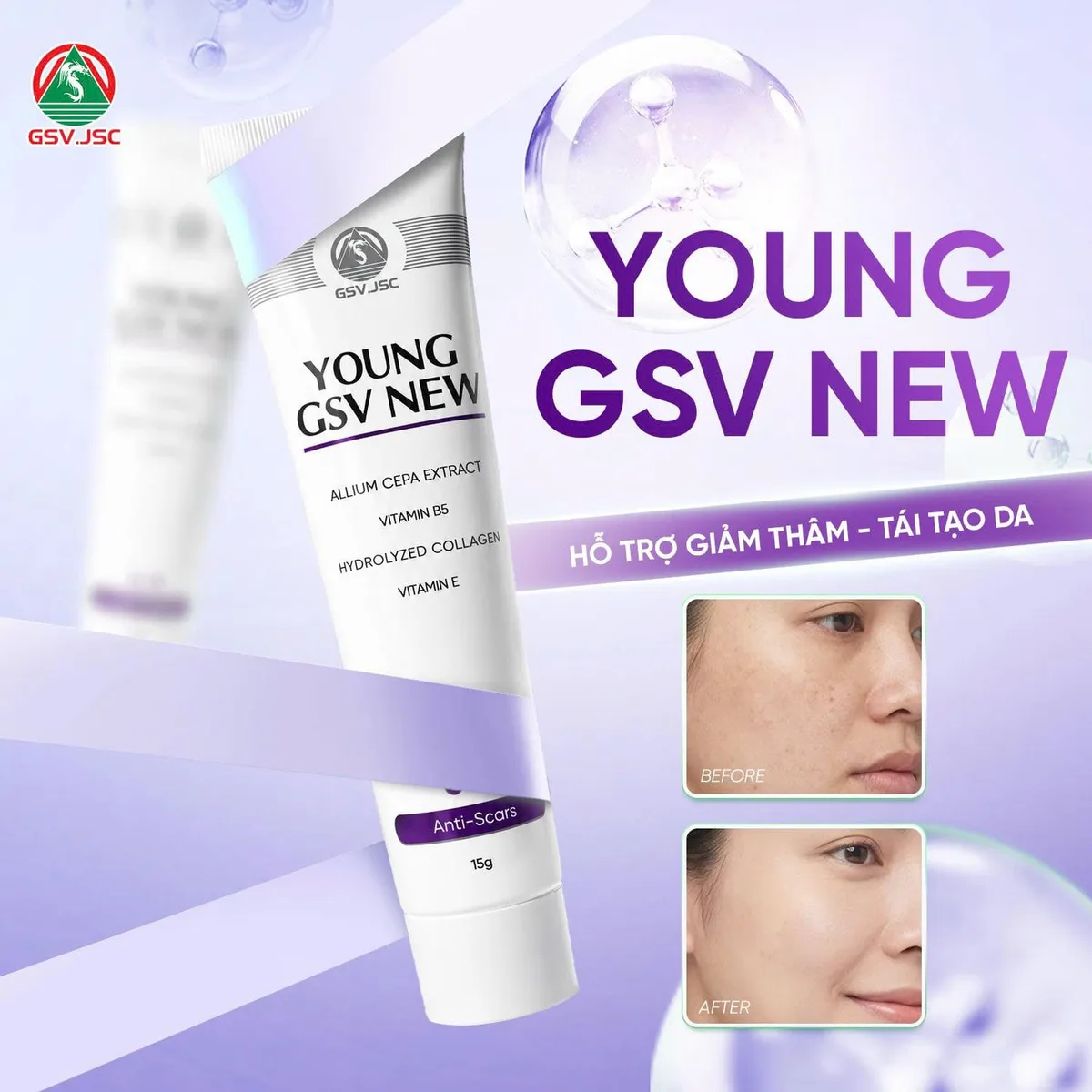 Gel Làm Mờ Sẹo Young GSV New Hỗ Trợ Giảm Thâm Mụn Sạm Nám Tái Tạo Da Với Allium Cepa Và Collagen 15g 7