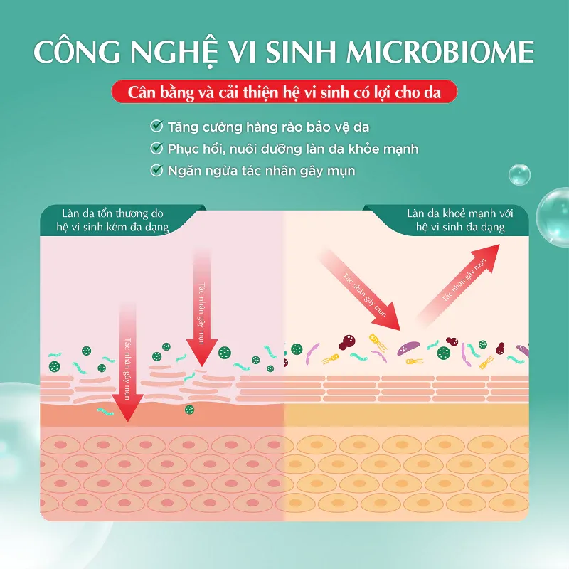 Gel Dưỡng Ẩm Hada Labo Acne Care Calming Gel Cream Ngừa Mụn Làm Dịu Cấp Ẩm Cho Da Mụn Da Nhạy Cảm 50g 4