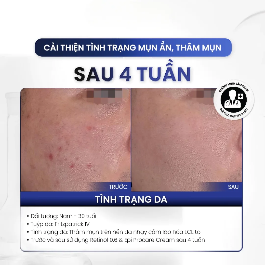 Kem Dưỡng Đêm MD Care Pro Retinol Hỗ Trợ Làm Sáng Da Cải Thiện Nếp Nhăn Và Dấu Hiệu Lão Hóa 30ml 5