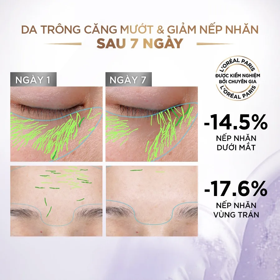 Serum Dưỡng L'Oreal Paris Revitalift 1.5% Hyaluronic Acid Cấp Ẩm Tức Thì Làm Giảm Nếp Nhăn Căng Mướt Da 30ml 5