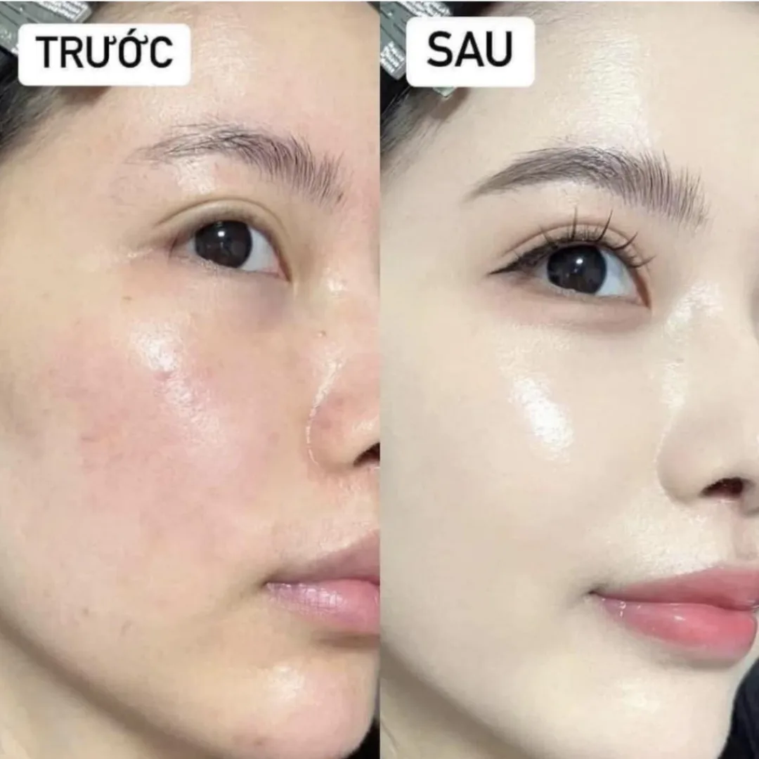 Mặt Nạ Banobagi Premium Vita Genic Jelly Mask Và Stem Cell Vitamin Mask Dưỡng Da Chuyên Sâu 30g 2