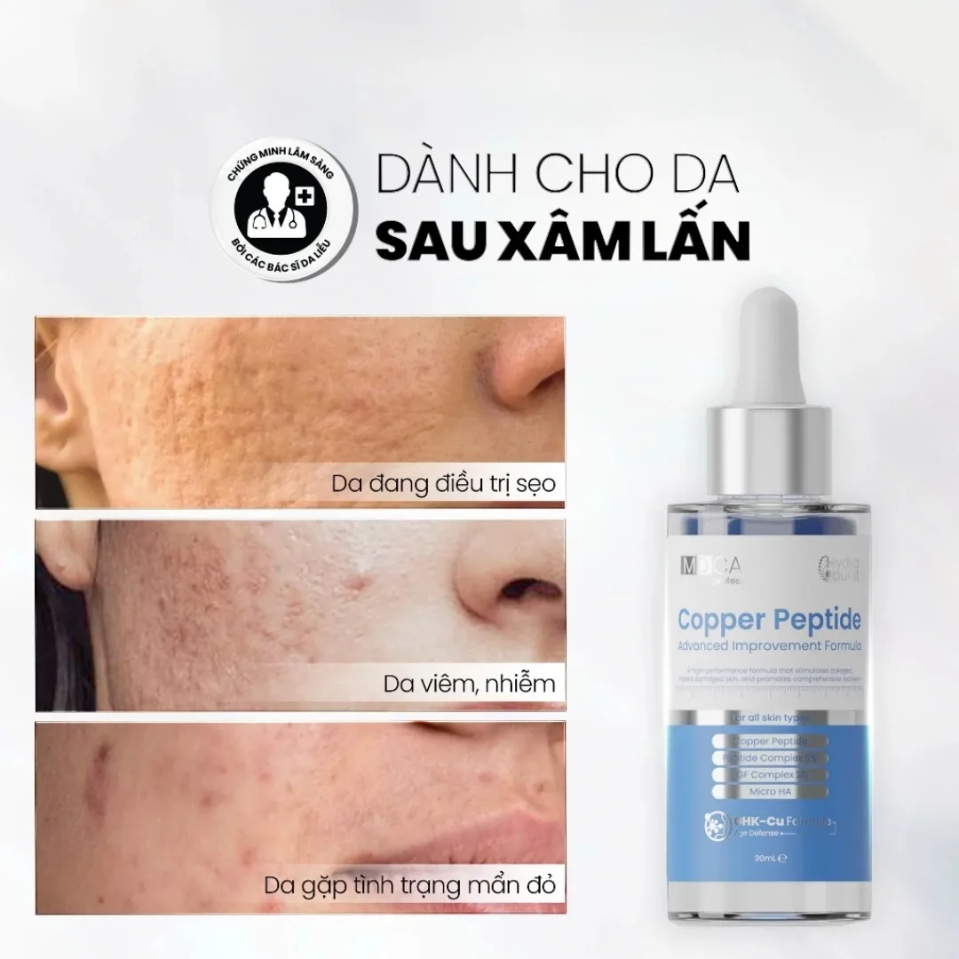 Tinh Chất Phục Hồi MD CARE Copper Peptide Serum Hỗ Trợ Tăng Sinh Collagen Làm Đầy Sẹo Chống Lão Hóa 30ml 5