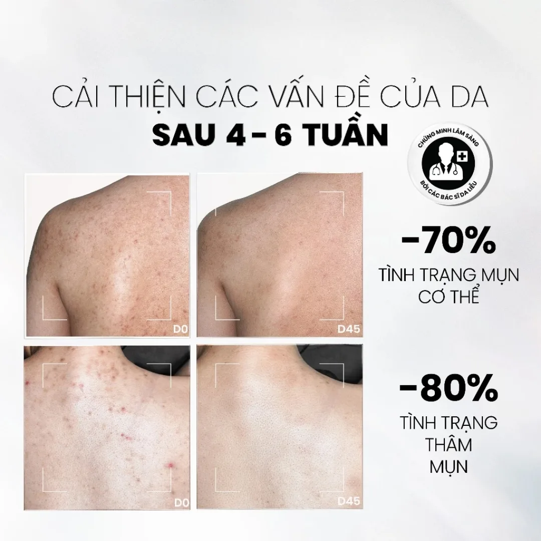 Xịt Tẩy Tế Bào Chết Toàn Thân MD Care Exfoliating Body Spray AHAs BHA Hỗ Trợ Giảm Mụn Lưng Ngực 100ml 6