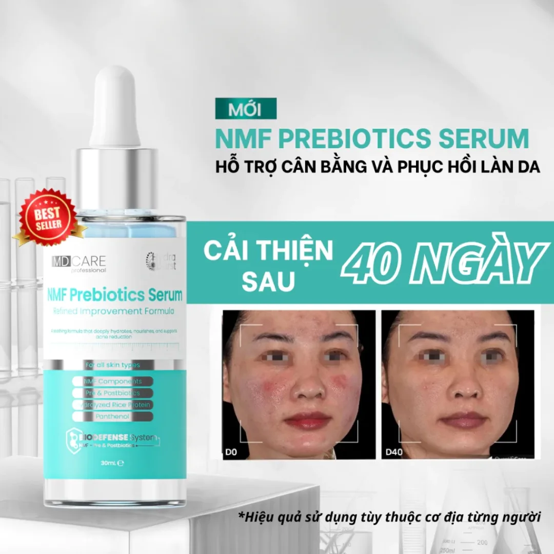 Tinh Chất Phục Hồi MD CARE NMF Prebiotics Serum Cân Bằng Lợi Khuẩn Hỗ Trợ Giảm Đỏ Cho Da Nhạy Cảm 30ml 2