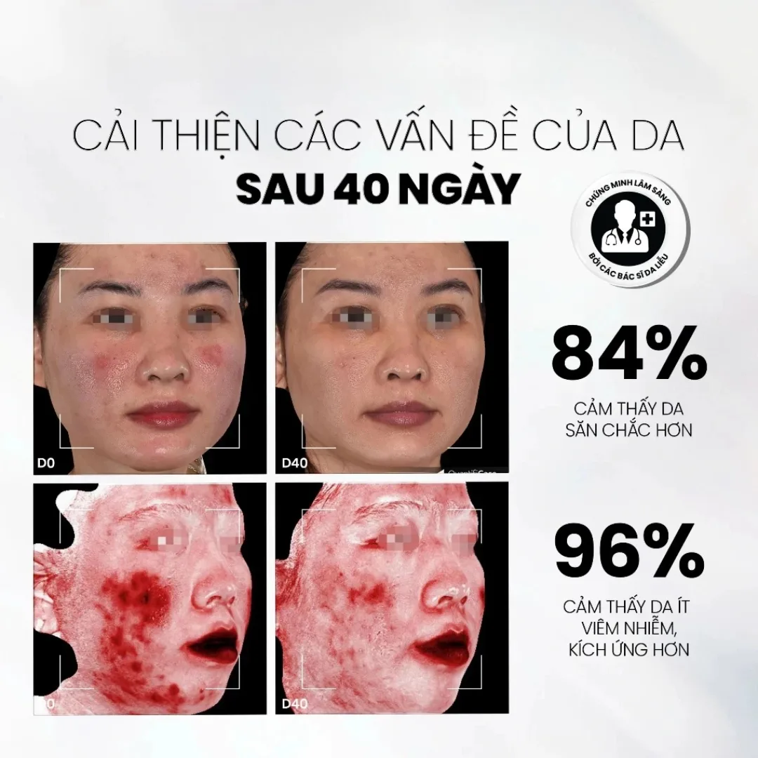 Tinh Chất Phục Hồi MD CARE NMF Prebiotics Serum Cân Bằng Lợi Khuẩn Hỗ Trợ Giảm Đỏ Cho Da Nhạy Cảm 30ml 6