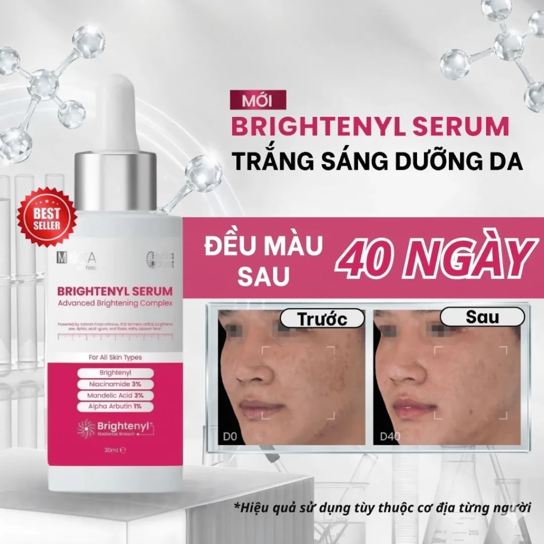 Tinh Chất Sáng Da MD CARE Brightenyl Serum Hỗ Trợ Làm Mờ Thâm Đều Màu Da Cho Da Xỉn Màu 30ml 2