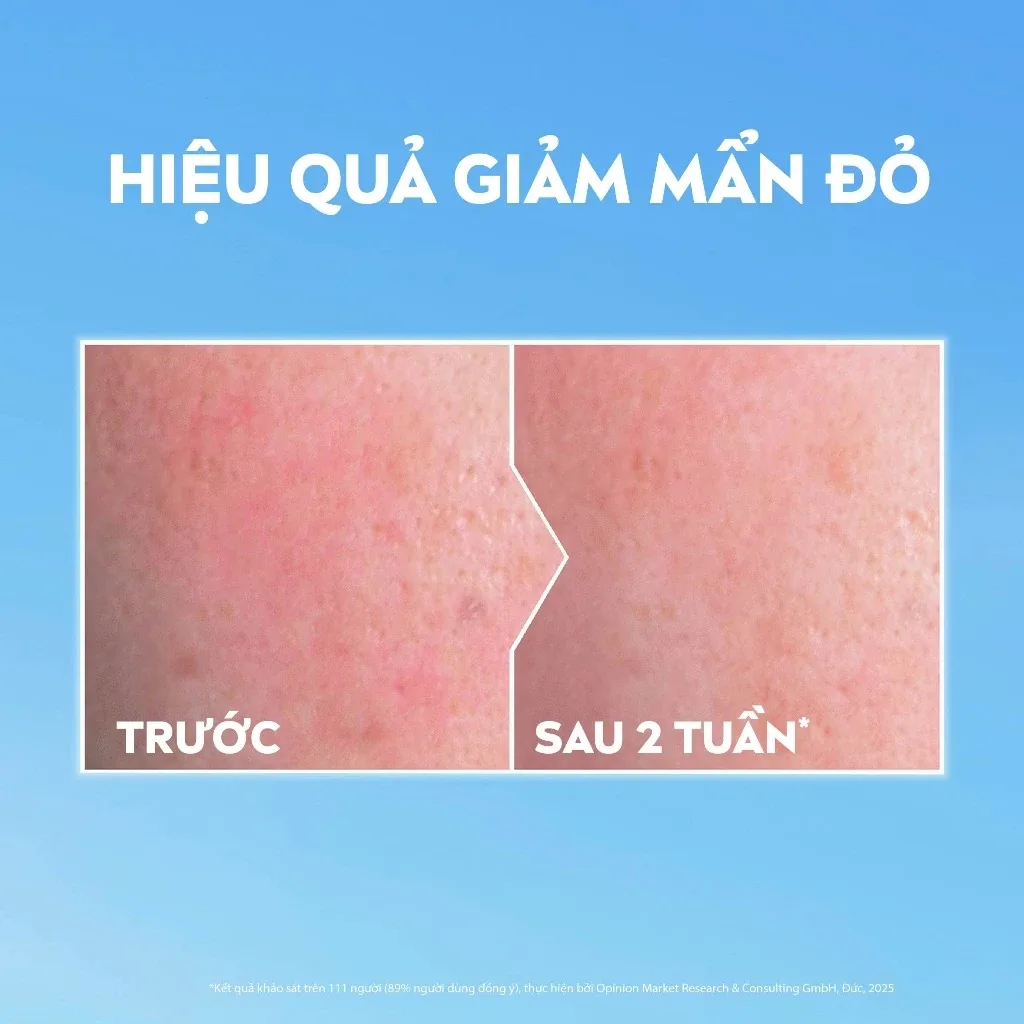 Nước Tẩy Trang NIVEA Soothing Micellar Water Làm Dịu Da Giảm Khô Mẩn Đỏ Kích Ứng Cho Da Nhạy Cảm 400ml 3