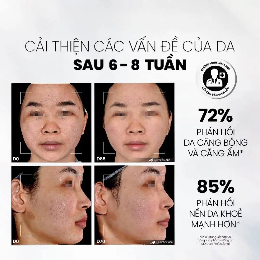 Sữa Rửa Mặt MD CARE Mandelic Acid 5% Dạng Gel Làm Sạch Sâu Tẩy Tế Bào Chết Nhẹ Nhàng Cho Da Dầu Mụn 30ml/200ml 5