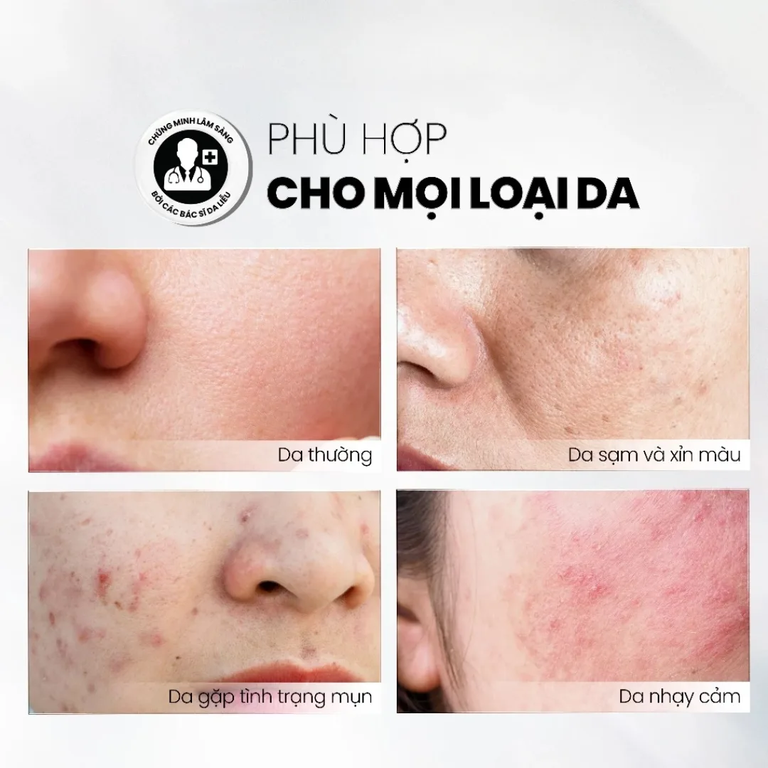 Tinh Chất Tẩy Tế Bào Chết MD CARE Glow Exfo Hỗ Trợ Làm Sáng Mờ Thâm Đều Màu Da Cho Da Xỉn Màu 10ml/30ml 5