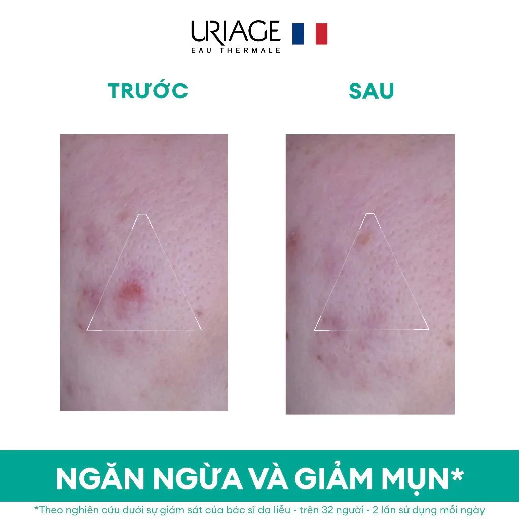Kem Dưỡng Uriage Hyséac 3-Regul Hỗ Trợ Giảm Mụn Kiềm Dầu Ngăn Ngừa Mụn Trứng Cá Cho Da Dầu 40ml 4